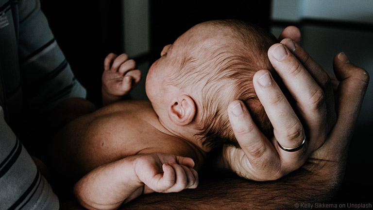 Neugeborenen-Akne – muss ich mir Sorgen machen?